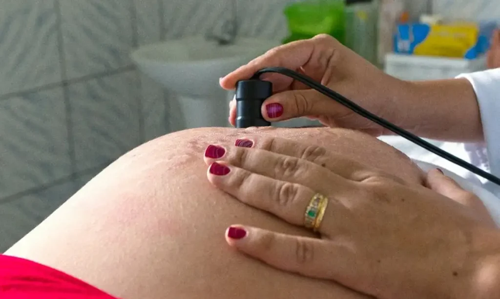 Risco de morte materna cai até 31% entre quem recebe o Bolsa Família 11 risco de morte materna cai ate 31 entre quem recebe o bolsa familia