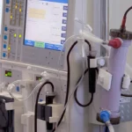 Estudo alerta para subdiagnóstico da doença renal crônica no Brasil